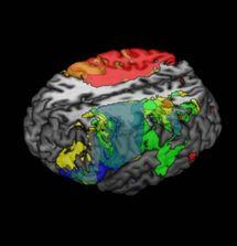 Crean el mapa cerebral más completo de la inteligencia humana