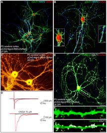 Crean neuronas a partir de otras células del cerebro