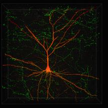 Una nueva clasificación de neuronas agilizará la investigación en Neurociencia