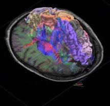 Crean el primer atlas integral del cerebro humano