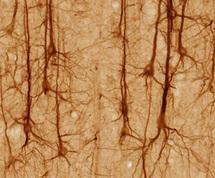Neuronas producidas a partir de células de la piel podrían curar el Parkinson
