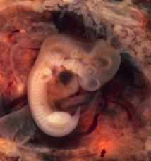 Un estudio relaciona la genética embrional con la aparición de tumores 