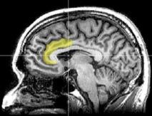 La neurociencia define los circuitos neuronales vinculados al racismo