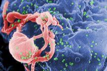Un gel vaginal evitará la transmisión sexual del virus del SIDA