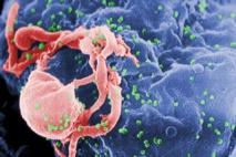 ¿Es el sida una antigua enfermedad humana?