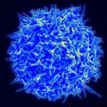 Diseñan en laboratorio células inmunes resistentes al SIDA