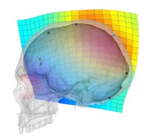 La evolución del cráneo humano ha propiciado problemas visuales y neurológicos