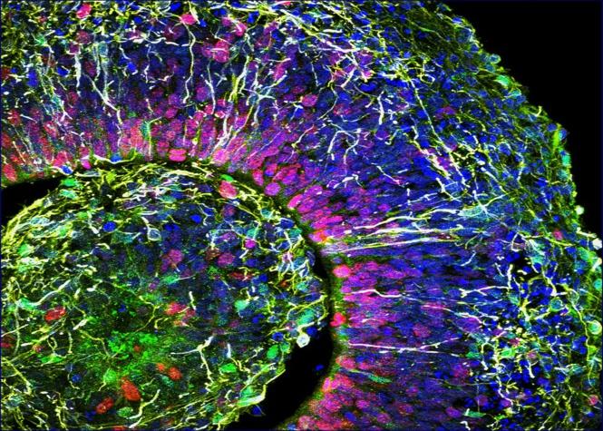 Mini cerebros humanos creados en laboratorio tienen actividad neurológica