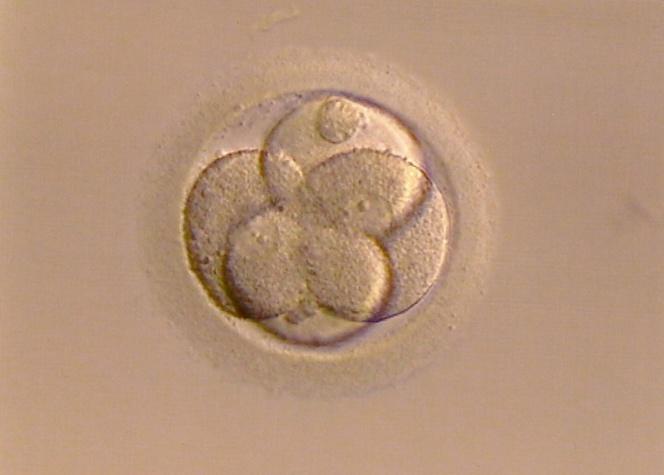 Primeros gemelos semiidénticos identificados en el embarazo