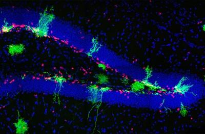 Descubren la fuente de nuevas neuronas en el hipocampo cerebral