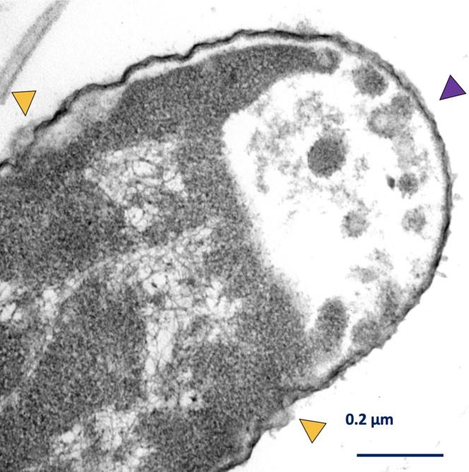 La nanotecnología puede con las superbacterias y el cáncer