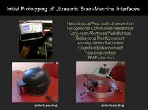 Crean un casco que controla la actividad neuronal con ultrasonidos