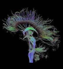 El cerebro humano madura igual que Internet