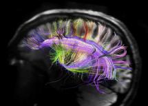 Un nuevo mapa del cerebro desvela la complejidad de las conexiones nerviosas