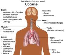 La luz detecta y controla la adicción a la cocaína