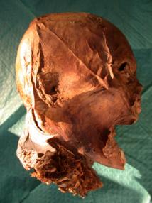 Una comparación genética revela que la cabeza momificada de Enrique IV es auténtica