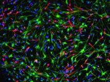 Células de la piel reprogramadas podrían curar la esclerosis múltiple