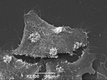 Bacterias que funcionan como jeringuillas microscópicas