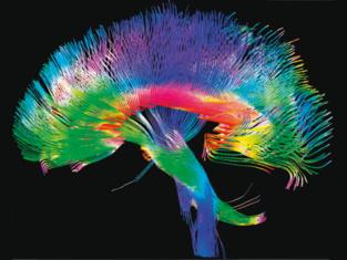 El cerebro funciona mediante "avalanchas" de actividad neuronal