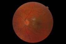 Imprimen células del ojo para crear un tejido que cure la ceguera