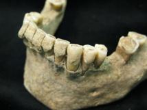 Descubren un “yacimiento” microbiano en dientes humanos de 1.000 años