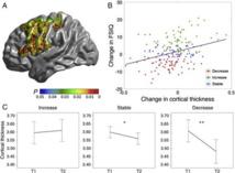 La reducción del grosor de la corteza cerebral con la edad afecta a la inteligencia