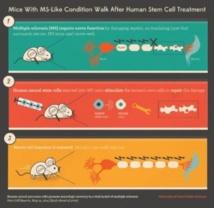 Ratones con esclerosis múltiple mejoran al tratarlos con células madre humanas