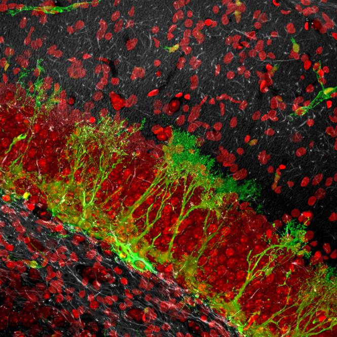 La agresión genera nuevas neuronas en el cerebro