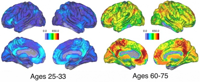El cerebro desarrolla nuevas estrategias cuando envejece