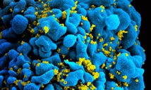 La membrana que envuelve al VIH puede ser su punto débil
