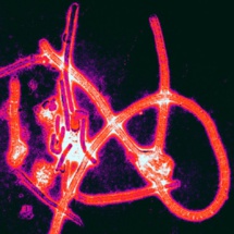 Una nueva vacuna experimental protege del Ébola a largo plazo