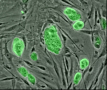 Las células madre cancerígenas poseen una propiedad luminosa que permite rastrearlas