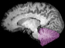 Una rápida evolución del cerebelo podría cambiar la historia del cerebro humano