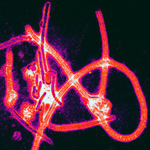 Decálogo de preguntas y respuestas sobre el contagio del ébola