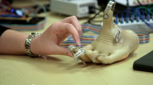 Nuevas prótesis de manos y brazos ayudan a amputados a recuperar sensaciones 