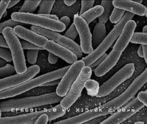 Consiguen neutralizar bacterias sin usar antibióticos: con nanopartículas 
