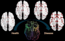 Las proteínas del alzhéimer se propagan por el cerebro como una epidemia por la sociedad