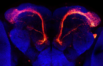 Neuronas del sistema olfativo están implicadas en el Alzheimer y el Parkinson