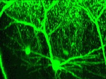 Las neuronas adultas también se regeneran