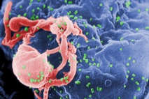 Un gel previene la infección por VIH entre 18 y 24 horas 