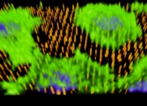 Unas nanoagujas impulsan el desarrollo de nuevos vasos sanguíneos 