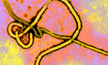 Desarrollan clones de anticuerpos contra el VIH y una vacuna monodosis contra el ébola