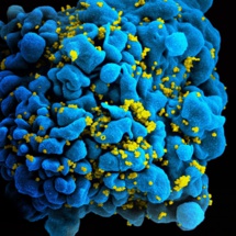 Un abrelatas molecular para destruir el virus del sida