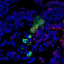 Nuevo tipo de células madre para el desarrollo de órganos de sustitución 