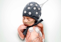 Los terremotos ayudan a comprender el cerebro de los bebés prematuros