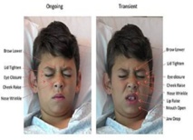 Un software identifica el nivel de dolor de los niños, a partir de sus expresiones faciales