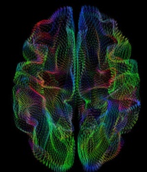 La forma de la corteza cerebral depende del linaje genético