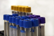Un nuevo test detecta el cáncer a partir de una sola gota de sangre