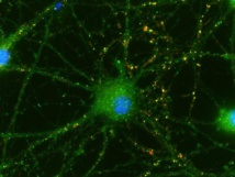 Las células del cordón umbilical mejoran las sinapsis de la retina