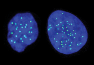 Desarrollan células madre con la mitad de cromosomas
